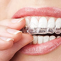 Person putting on Invisalign